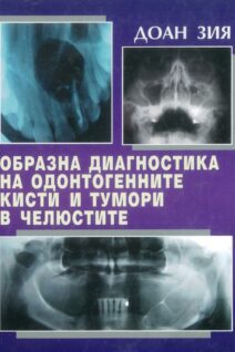 Imaging diagnostics of odontogenic cysts and tumors in the jaws