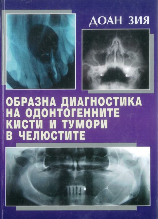 Образна диагностика на одонтогенните кисти и тумори в челюстите