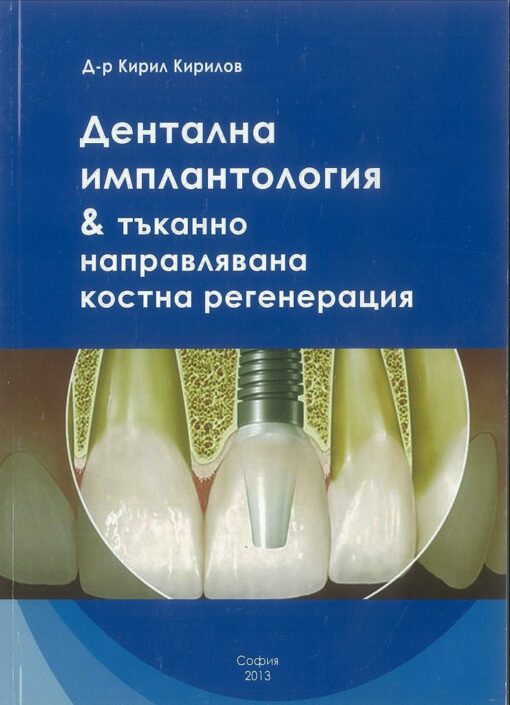 Dental Implantology