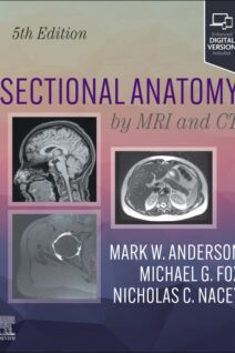 Sectional Anatomy by MRI and CT