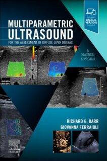 Multiparametric Ultrasound for the Assessment of Diffuse Liver Disease