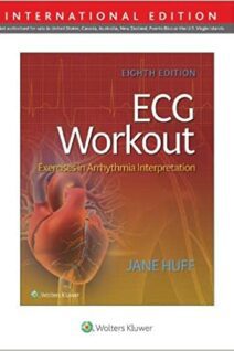 ECG Workout Exercises in Arrythmia Interpretation