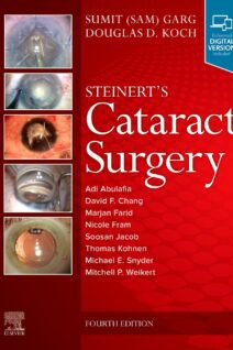 Steinert's Cataract Surgery