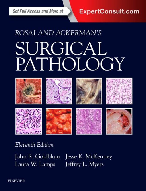 Rosai and Ackerman's Surgical Pathology