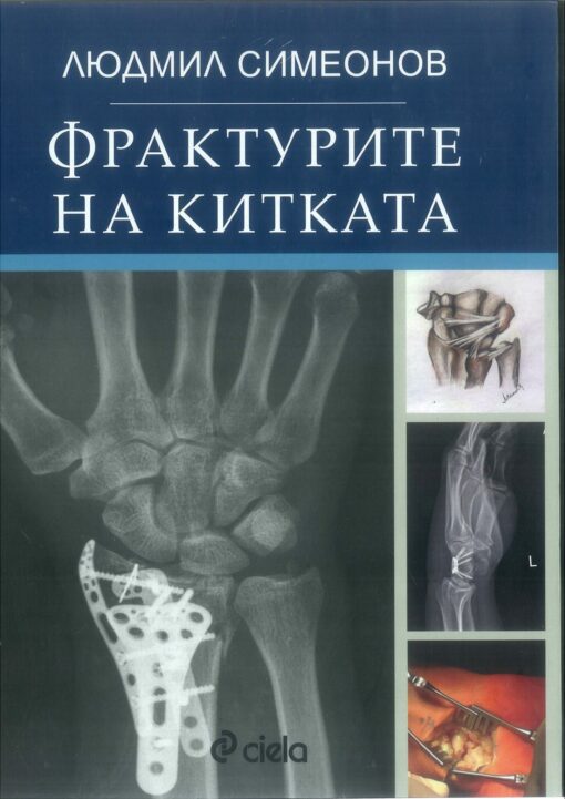 Fractures of the wrist