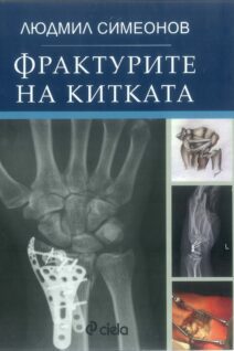 Fractures of the wrist