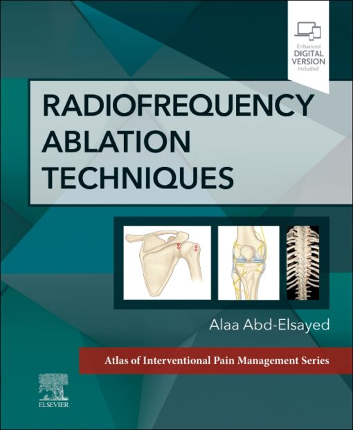 Radiofrequency Ablation Techniques