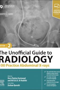 The Unofficial Guide to Radiology: 100 Practice Abdominal X-rays