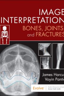 Image Interpretation: Bones Joints and Fractures