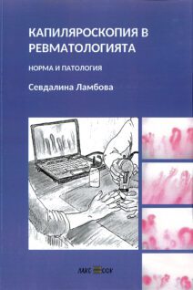 Капиляроскопия в ревматологията - норма и патология