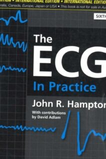 The ECG In Practice, 6e 