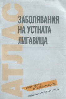Заболяване на устната лигавица