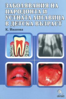 Забиляване на пародонта и устната лигавица в детска възраст