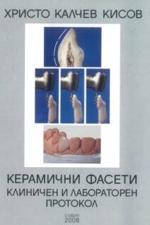 Керамични фасети