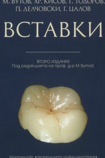 Вставки - 2ро издание