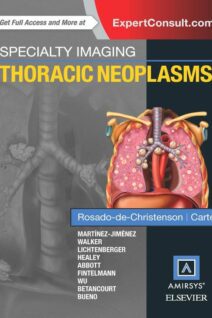 Specialty Imaging: Thoracic Neoplasms, 1st Edition