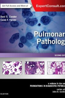 Pulmonary Pathology, 2nd Edition
