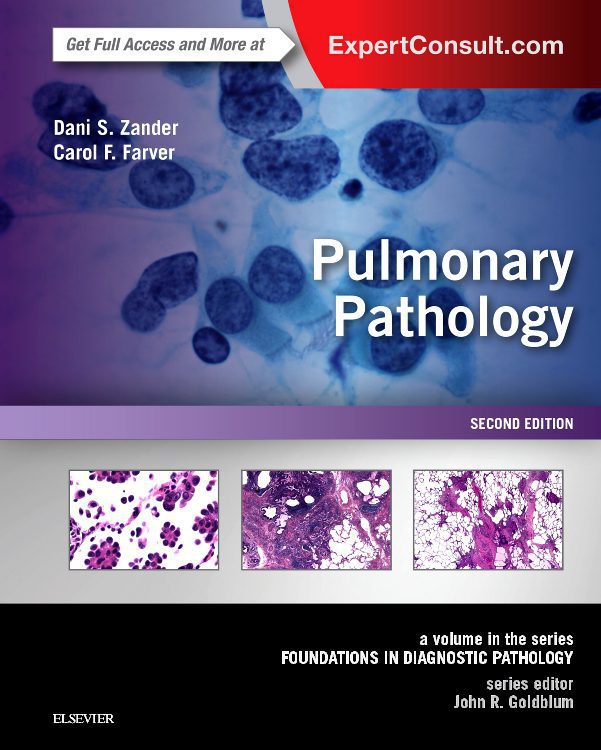 Pulmonary Pathology, 2nd Edition - Сити Център Варна МЕДИЦИНСКА ЛИТЕРАТУРА