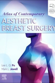 Atlas of Contemporary Aesthetic Breast Surgery, 1st Edition