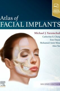 Atlas of Facial Implants, 2nd Edition