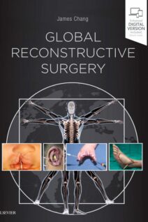 Global Reconstructive Surgery, 1st Edition