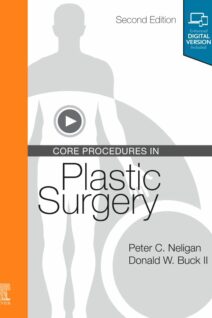 Core Procedures in Plastic Surgery, 2nd Edition