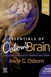 Essentials of Osborn's Brain, 1st Edition