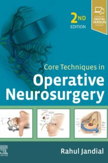 Core Techniques in Operative Neurosurgery, 2nd Edition