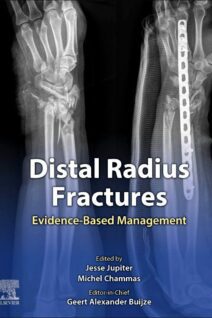 Distal Radius Fractures, 1st Edition
