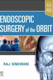 Endoscopic Surgery of the Orbit, 1st Edition