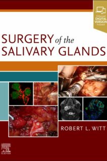 Surgery of the Salivary Glands, 1st Edition