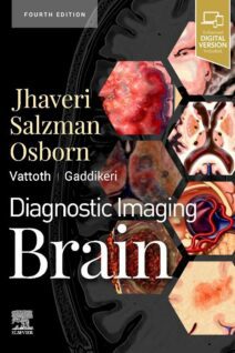 Diagnostic Imaging: Brain, 4th Edition