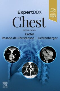 ExpertDDx: Chest, 2nd Edition