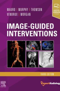 Image-Guided Interventions, 3rd Edition