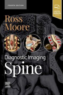 Diagnostic Imaging: Spine, 4th Edition