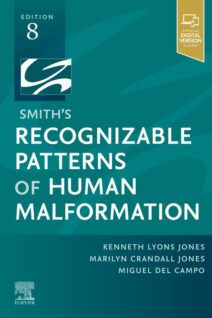 Smith's Recognizable Patterns of Human Malformation, 8th Edition
