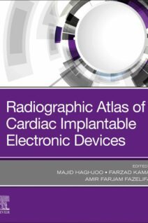 Radiographic Atlas of Cardiac Implantable Electronic Devices, 1st Edition