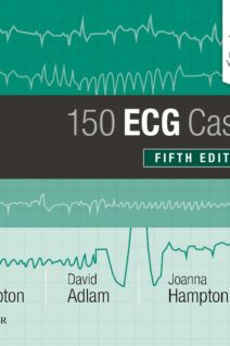 150 ECG Cases, 5th Edition