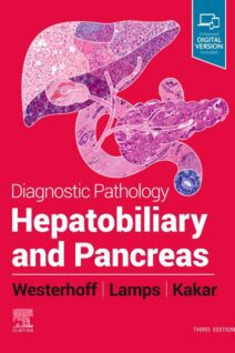 Diagnostic Pathology : Hepatobiliary and Pancreas, 3rd Edition