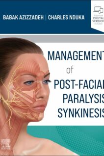 Management of Post-Facial Paralysis Synkinesis, 1st Edition
