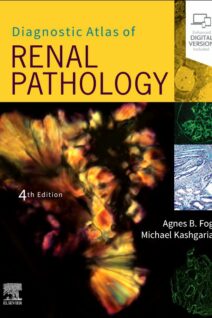 Diagnostic Atlas of Renal Pathology, 4th Edition