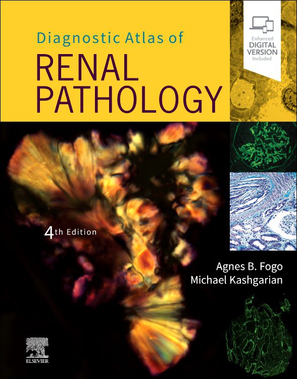 Diagnostic Atlas Of Renal Pathology, 4th Edition - Сити Център Варна ...