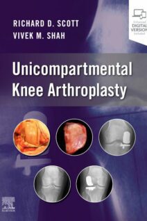 Unicompartmental Knee Arthroplasty, 1st Edition