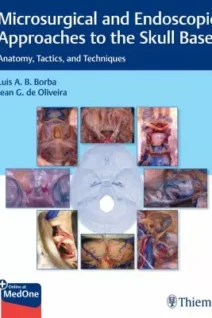 Microsurgical and Endoscopic Approaches to the Skull Base