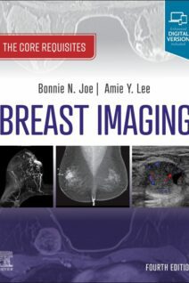 Breast Imaging