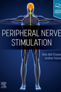 Peripheral Nerve Stimulation