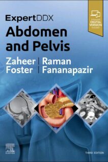 ExpertDDx: Abdomen and Pelvis