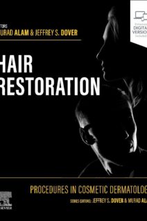Procedures in Cosmetic Dermatology: Hair Restoration