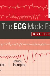 The ECG Made Easy