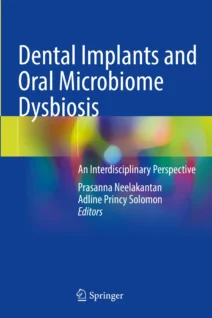 Dental Implants and Oral Microbiome Dysbiosis An Interdisciplinary Perspective